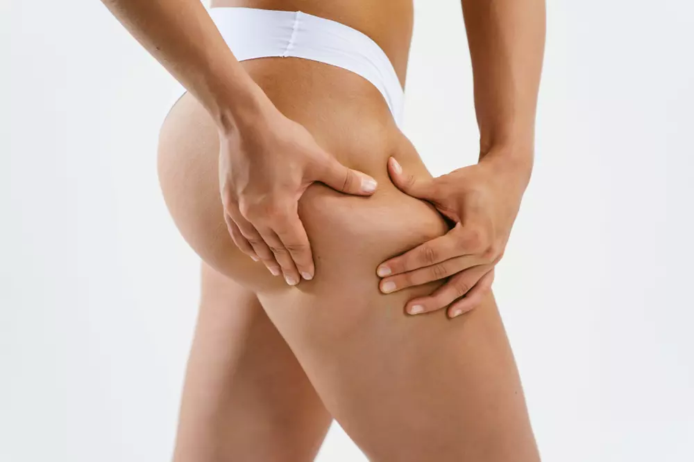 Up to 56% Off on Thighs - Non-Surgical at Beauty By Design