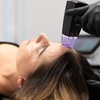 Image 1: Up to 55% Off on Advanced Microneedling & Radiofrequency