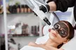 Get One or Three Skin Brightening Laser Treatment (nd yag Laser) at Maven Aesthetics Studio- Up to 51% Off o - Second Medium