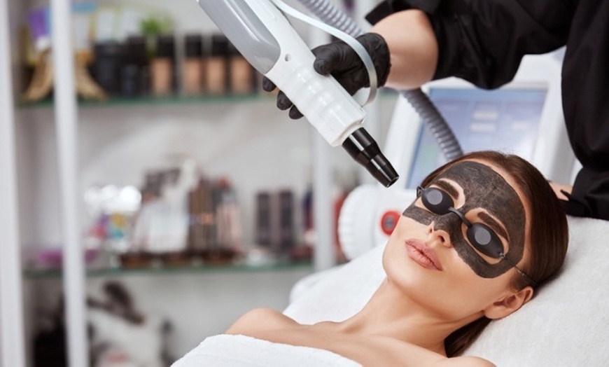 Image 2: Get One or Three Skin Brightening Laser Treatment (nd yag Laser) 