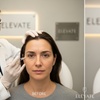Image 2: 20, 40, or 60 Units of Botox Injections for Rejuvenating Your Skin