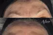 Revamp Your Look with Brazilian Wax or Brow Lamination at A.Esthetics - Up to 37% Off - Second Medium
