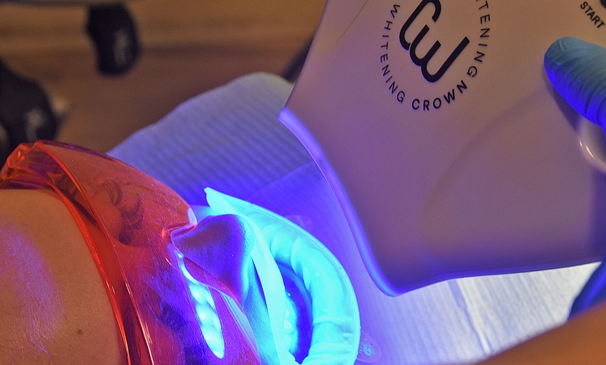 Image 2: In-Office Crown Whitening Treatment with Consultation and Optional Whitening Kit at Green Dental (Up to 52% Off)