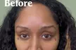 Achieve Stylish Brows with Ombré Shading & Nano Combo Brows at Linesbylindaa (Up to 49% Off) - Second Medium