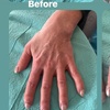 Image 1: One Syringe of Radiesse for Neck / Décolleté and Hand Rejuvenation at No Pain All Gain Spa (Up to 30% Off)
