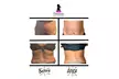 Cavitation & Lymphatic Stimulation – 90 Min Fat Reduction (Up to 51% Off) - Second Medium