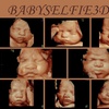 Image 1: Up to 30% Off on Ultrasound - 3D / 4D at BabySelfie
