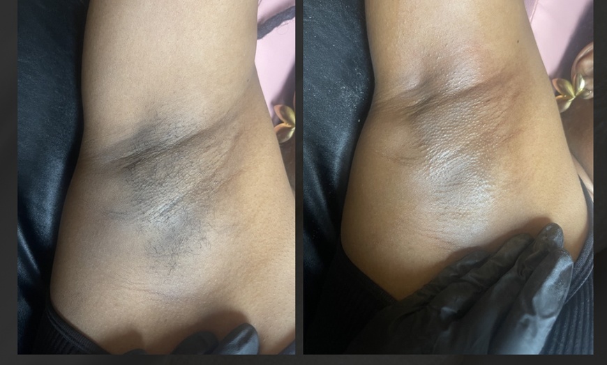Image 2: Up to 30% Off on Waxing - Brazilian at Madam Wax