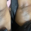 Image 2: Up to 30% Off on Waxing - Brazilian at Madam Wax