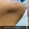 Image 1: Up to 50% Off on Laser Hair Removal at The Glam House Clinic