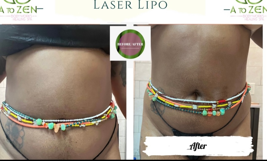 Image 2: Enhanced Post-Op Lymphatic Drainage Massages for Circulation & Healing