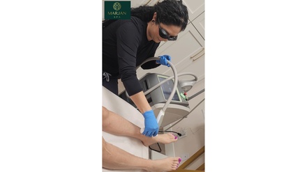 3 Laser Hair Removal Sessions on One Medium Area - Marjan Spa