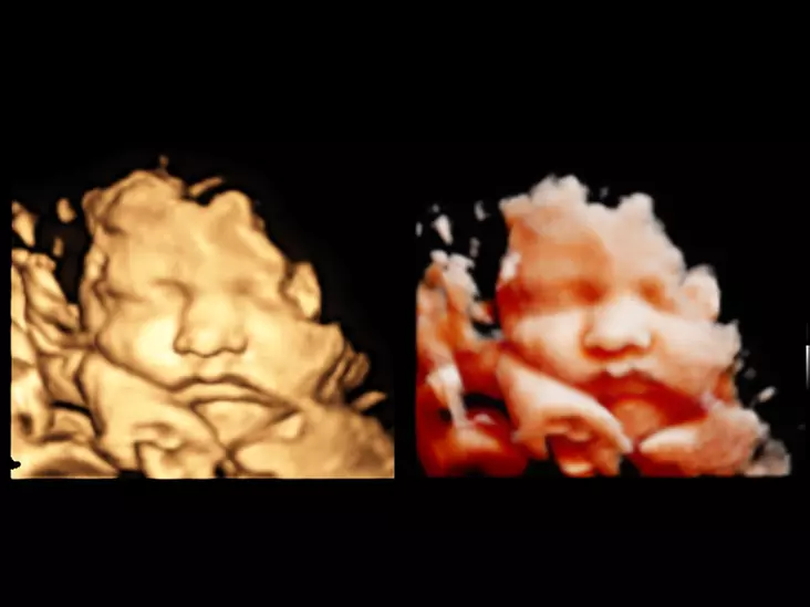 Up to 30% Off on Ultrasound - 3D / 4D at Memories In 4D - Primary Image