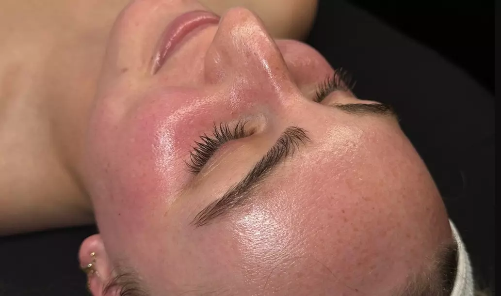 Up to 51% Off on Chemical Peel at JustSkin Esthetics