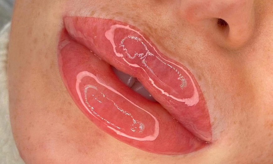 Image 1: Get Radiant Look with One Lip Blush or One Dark Lip Neutralisation 