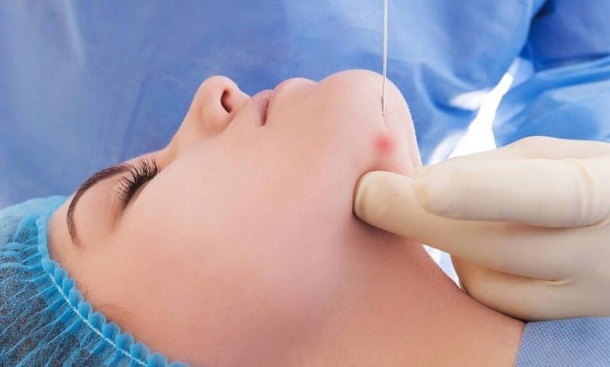 Image 2: Endolaser Treatments: Under-chin Contouring & Abdomen Skin Tightening 