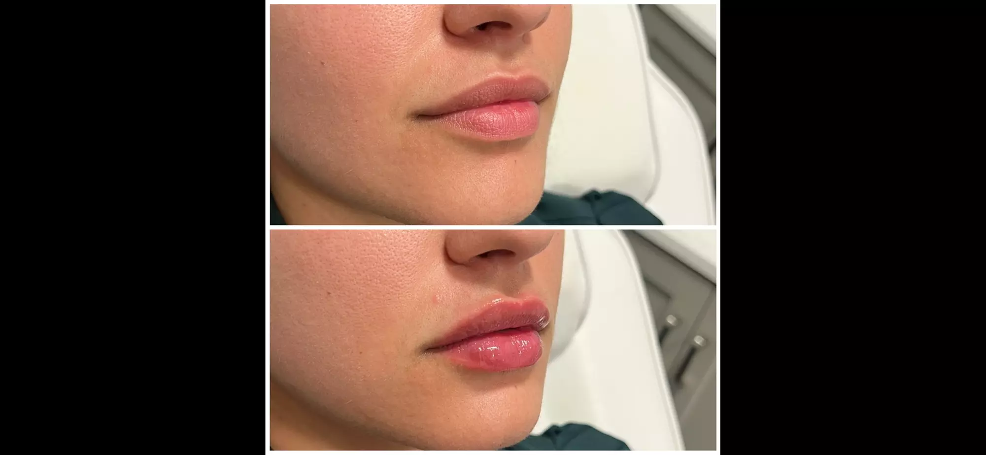 Up to 47% Off on  at Dermaesthetics