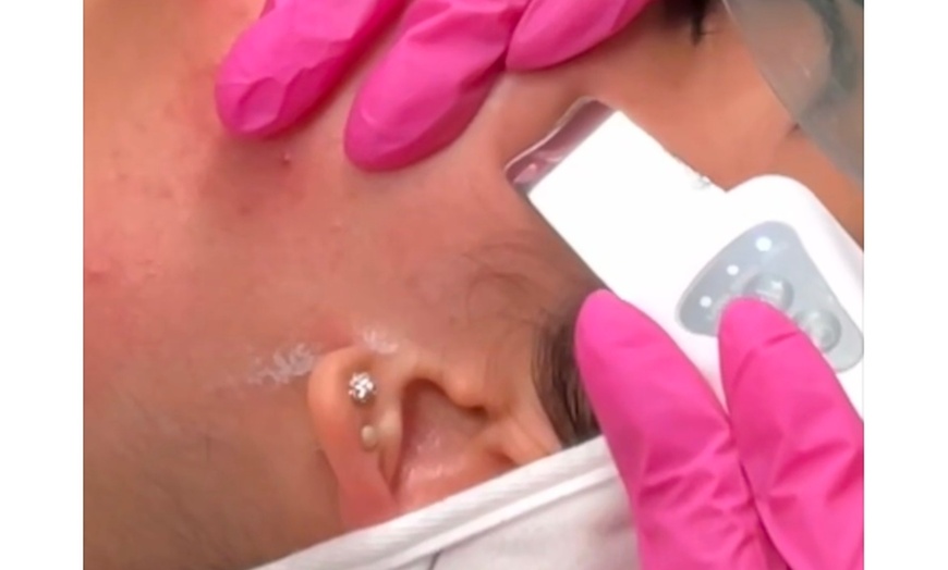 Image 1: Transform Your Skin with Pro Clear Two or Six Days Detox at SkinSecret @ Kingdom Beauty (Up to 35% Off)