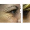 Image 1: Refresh Yourself with Xeomin Shots