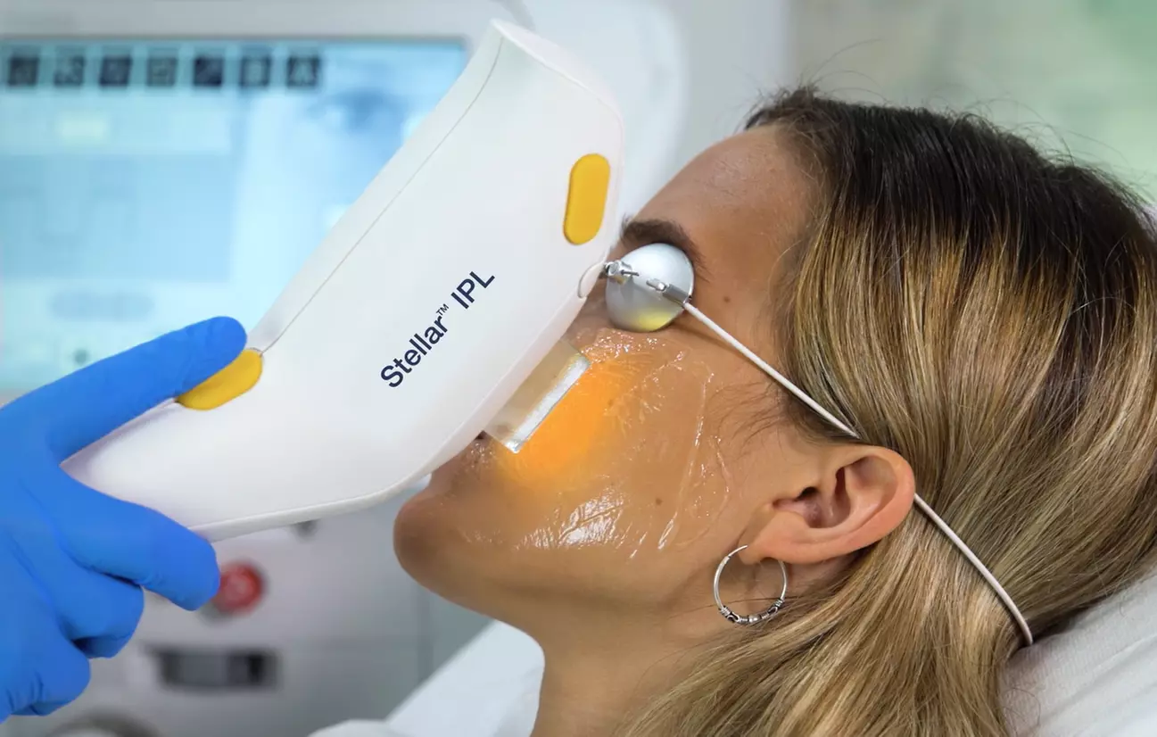 Up to 30% Off on IPL Photo Facial at Evergreen Clinic (Medical Spa)