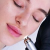 Image 1: Up to 35% Off on HydraFacial at Skin Work