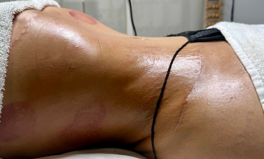 Image 3: Up to 58% Off on Lymphatic Drainage Massage at NU REVIVE LLC