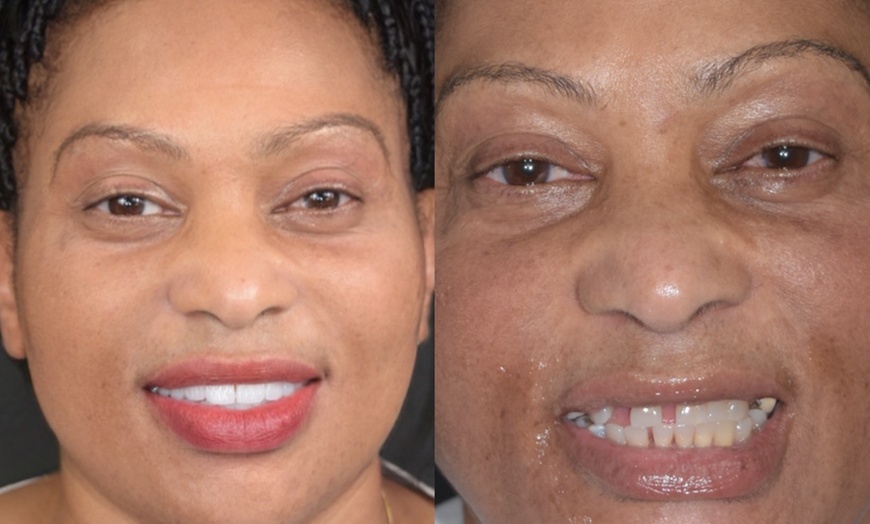 Image 7: Dental Crowns, Dental Exam, X-rays & Cleaning, Dentures & More