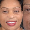Image 7: Dental Crowns, Dental Exam, X-rays & Cleaning, Dentures & More