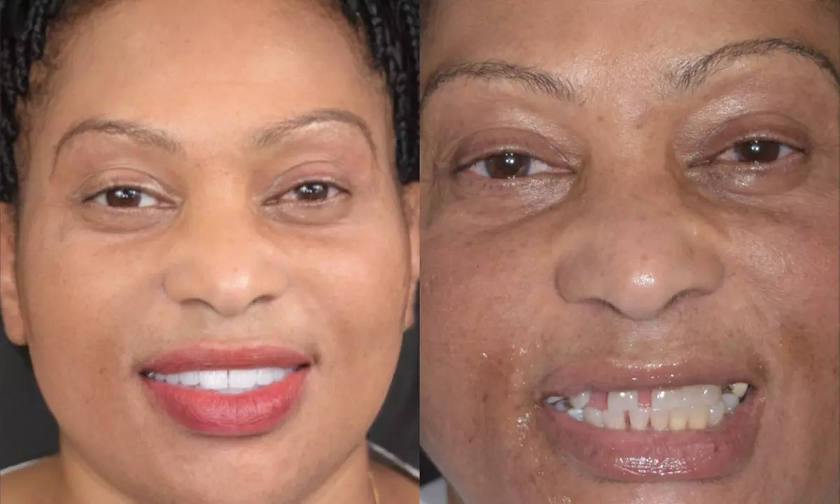 Dental Crowns, Dental Exam, X-rays & Cleaning, Dentures & More