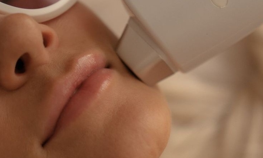 Image 1: Flawless Skin with Laser Hair Removal Six Sessions -Five or Three Area