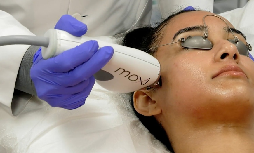 Image 2: Reveal a Clearer Complexion with BBL Hero Treatments! 