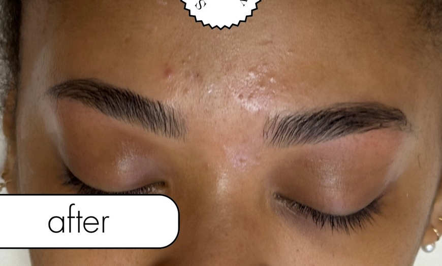 Image 2: Experience Smooth, Luxury Brazilian Waxing for Sensitive Skin