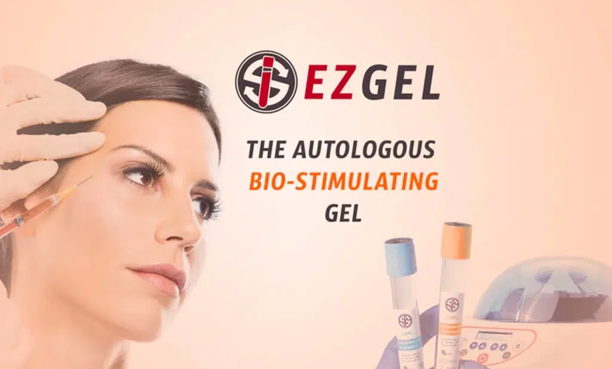 Image 2: Natural Rejuvenation w/ 1 Session EZ PRF for Under Eyes, Up to 3 Areas
