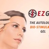 Image 2: Natural Rejuvenation w/ 1 Session EZ PRF for Under Eyes, Up to 3 Areas