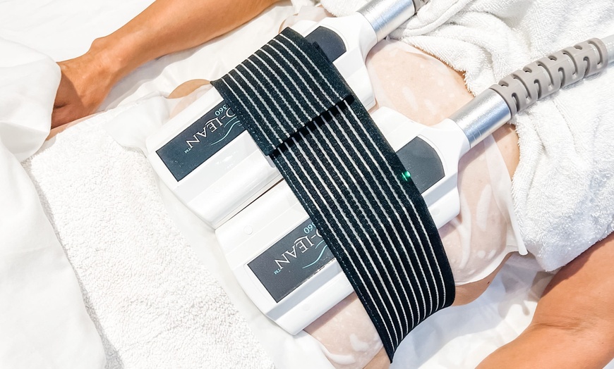 Image 2: Non-Invasive Cryo-Lipo Treatment for Stubborn Areas