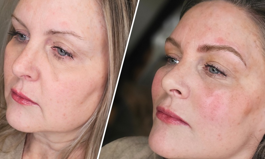 Image 3: Perfect Brows with One Microblading Session with or without Touch-Up 