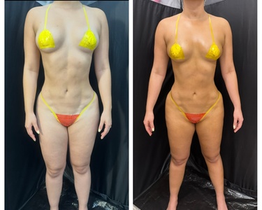 One Customized Airbrush Spray-Tan Session - Nefertiti spa