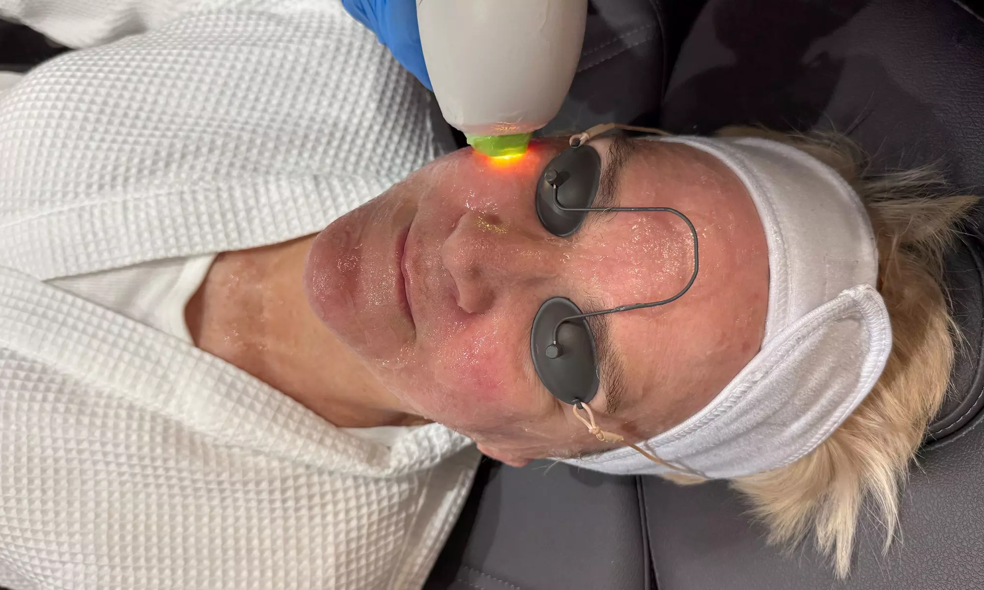 90-Min IPL Photofacial & Personalized Consultation for Women 45 Plus