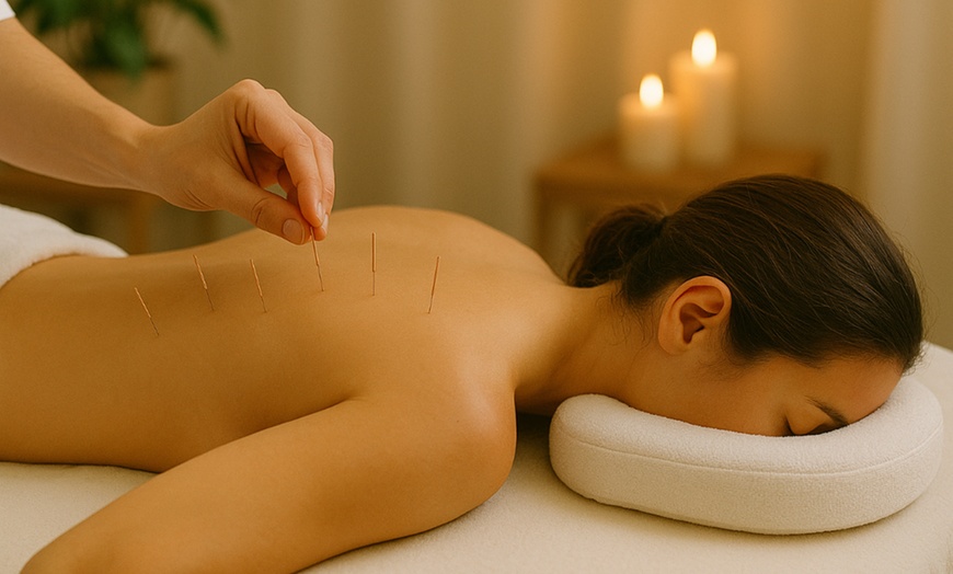Image 3: Health Review + Acupuncture & Cupping or Gua Sha treatment with Doctor of Acupuncture at Dao Integrated Health (Up to 61% Off)