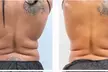 Ultrasonic Cavitation, Non-Invasive Laser Lipo and more at Sound Sculpting Solutions (Up to 69% Off) - Second Medium