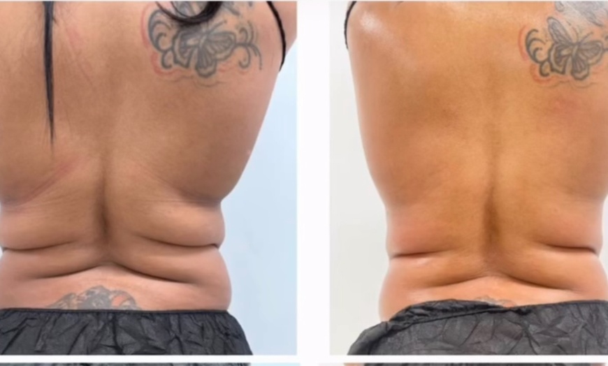 Image 3: One Hour Full Body Lymphatic Rub at Sound Sculpting Solutions