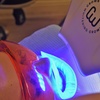 Image 2: Green Dental Ltd Offers Laser Teeth Whitening + Philip Zoom or Crown System With or Without Consultation