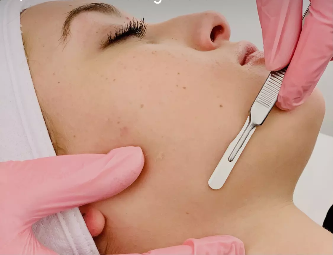Up to 44% Off on Facial - Collagen at Skinglam LA - Primary Image