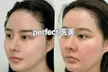 Up to 84% Off on HydraFacial at Magic Beauty Wellness - Second Medium