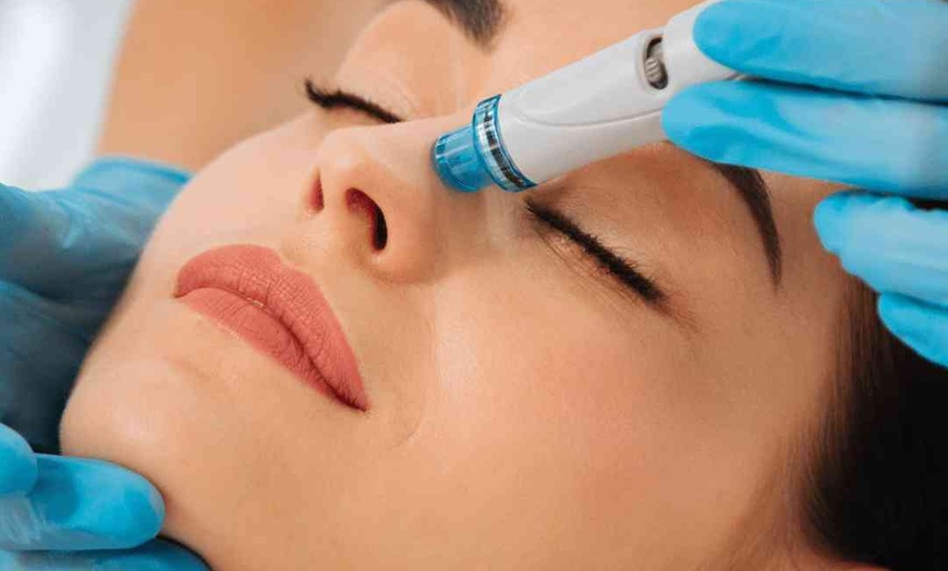 Image 2: Up to 37% Off on micro needling and advanced skin treatments