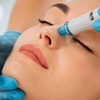 Image 2: Up to 37% Off on micro needling and advanced skin treatments