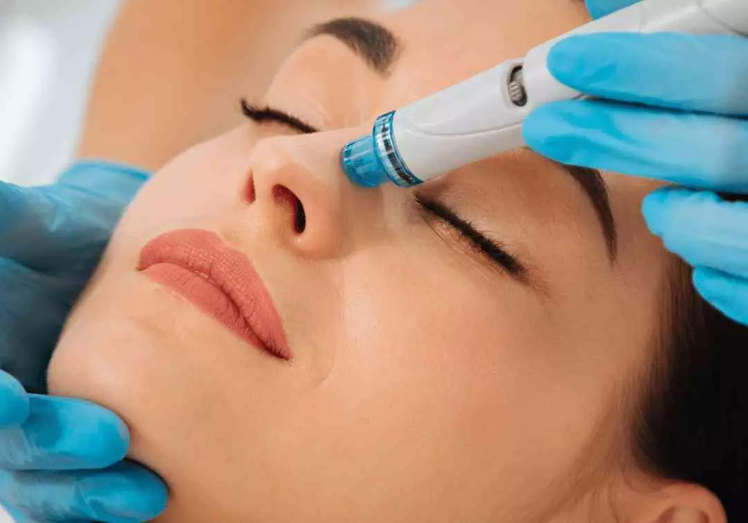 Up to 37% Off on micro needling and advanced skin treatments