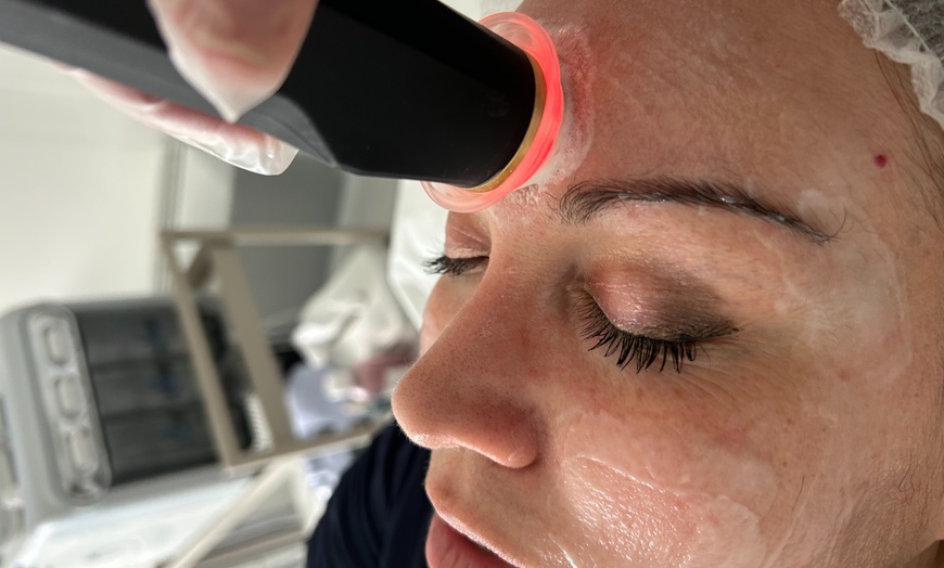 Image 3: Soin du visage Oxyderm : éclat et oxygénation
