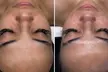 Celestial Skincare Offers One, Two, or Three 30-Minute Signature Hydrafacial Session for One (Up to 65% Off) - Image 3