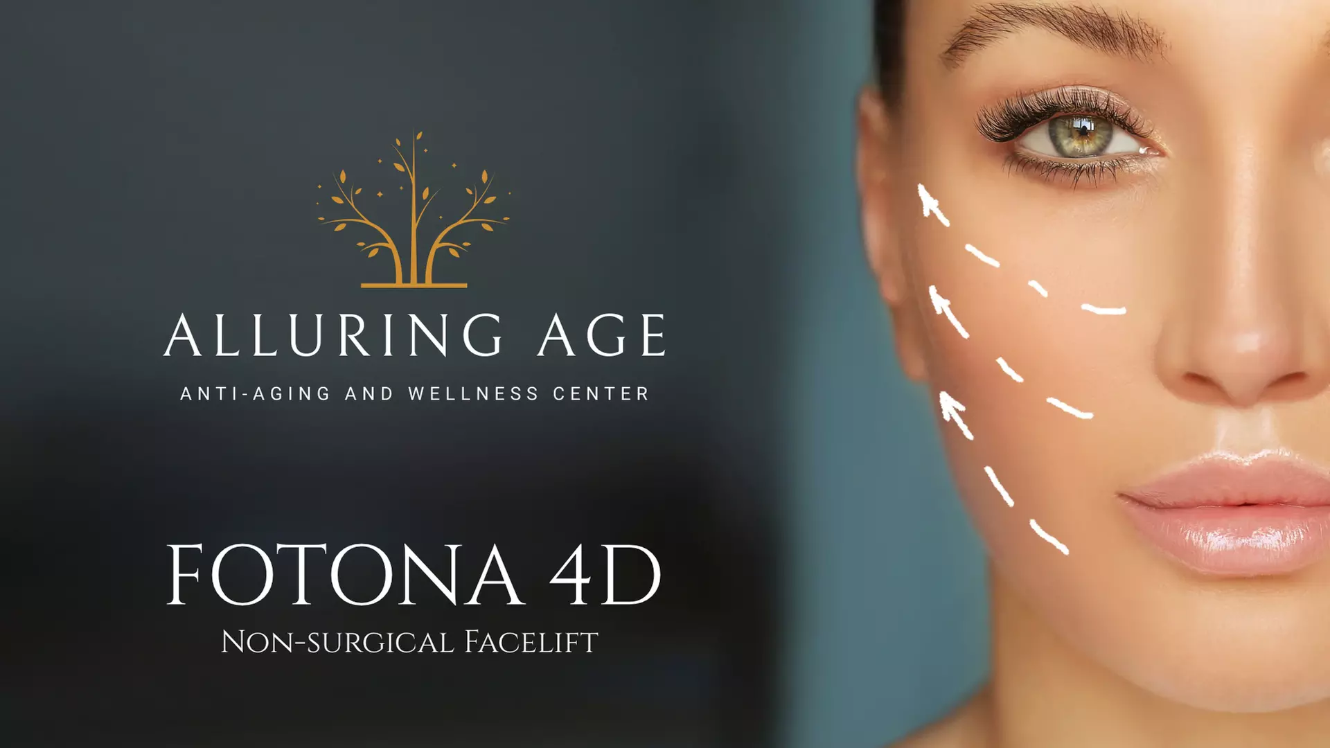 One, Two or Four Fotona 4D Non Surgical Facelifts at Alluring Age (Up to 62% Off) - Primary Image